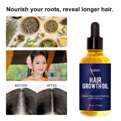 50ml Natural Organic Herbal Hair Growth Oil Serum Rosemary Castor Scalp Strengthening,oalen cosmetics