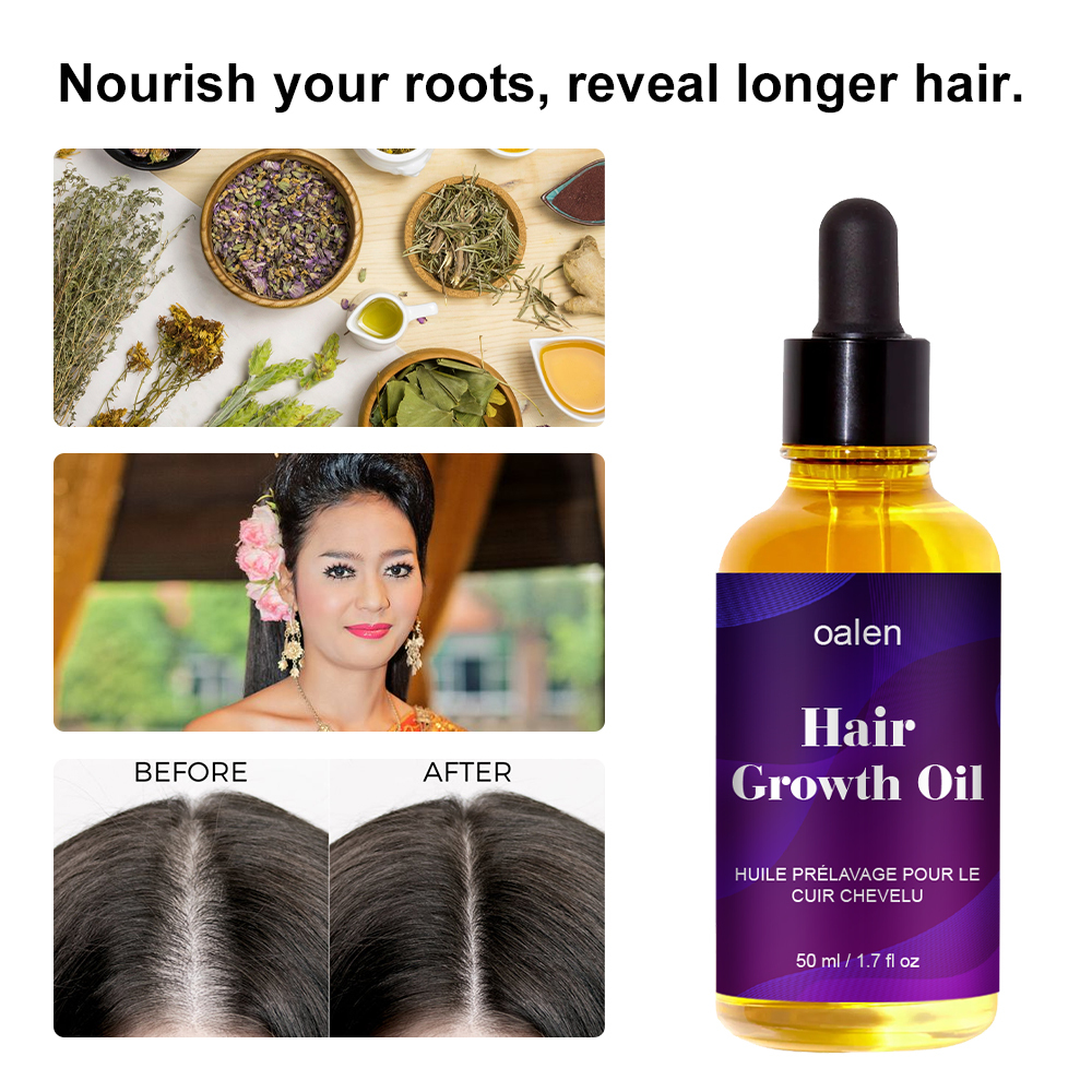 Organic Repair Serum Scalp Massage Hair Growth Oil Anti Hair Loss Keratin Rosemary Oil Hair Treatment,MY SHOP