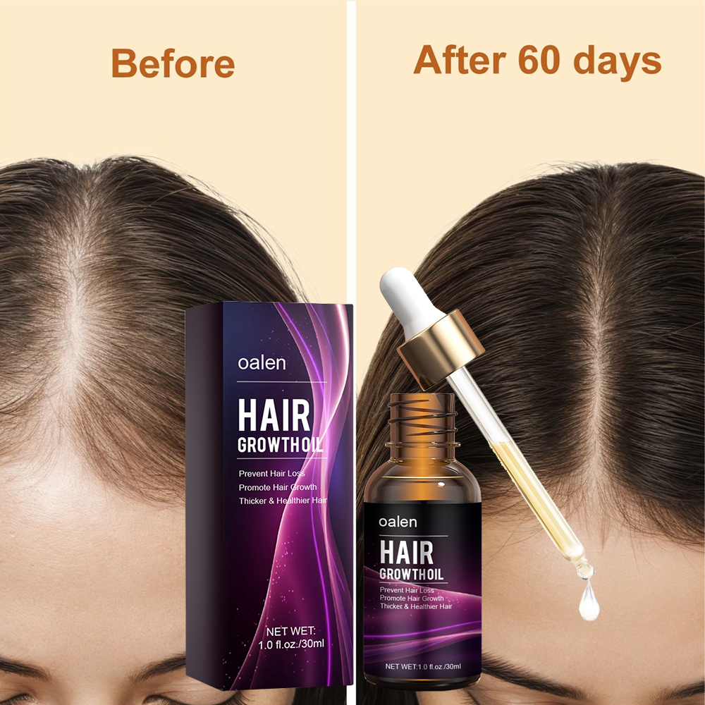 Organic Repair Serum Scalp Massage Hair Growth Oil Anti Hair Loss Keratin Rosemary Oil Hair Treatment,MY SHOP