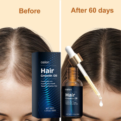 Hair Growth Oil Strengthening Nourishing Smoothing Hair Care Oils for Hair Growth Products,MY SHOP