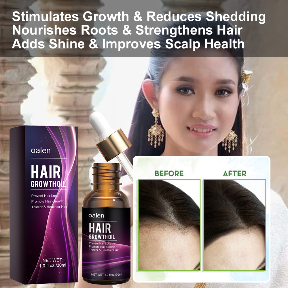 Organic Repair Serum Scalp Massage Hair Growth Oil Anti Hair Loss Keratin Rosemary Oil Hair Treatment,MY SHOP