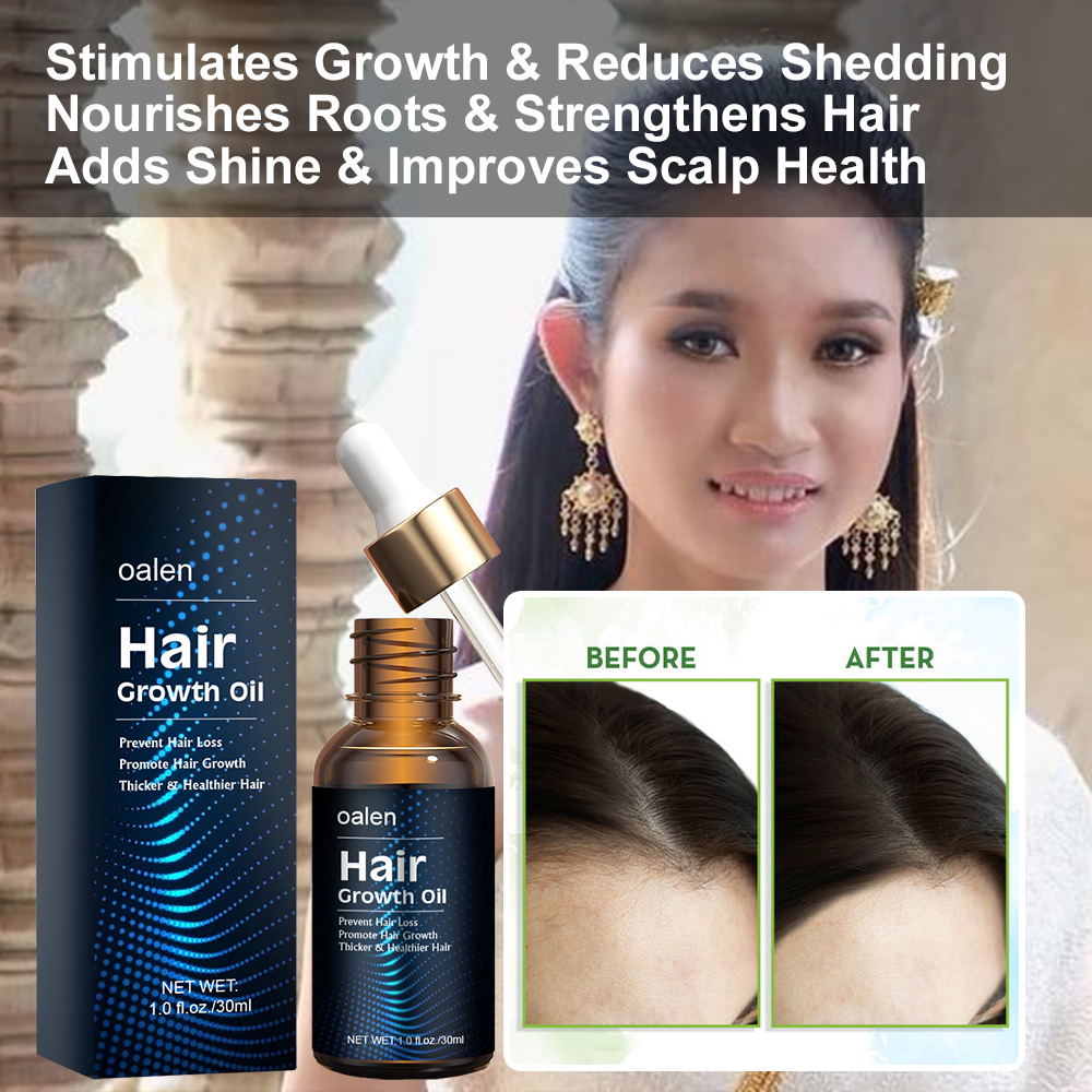 Hair Growth Oil Strengthening Nourishing Smoothing Hair Care Oils for Hair Growth Products,MY SHOP