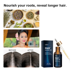 Hair Growth Oil Strengthening Nourishing Smoothing Hair Care Oils for Hair Growth Products,MY SHOP