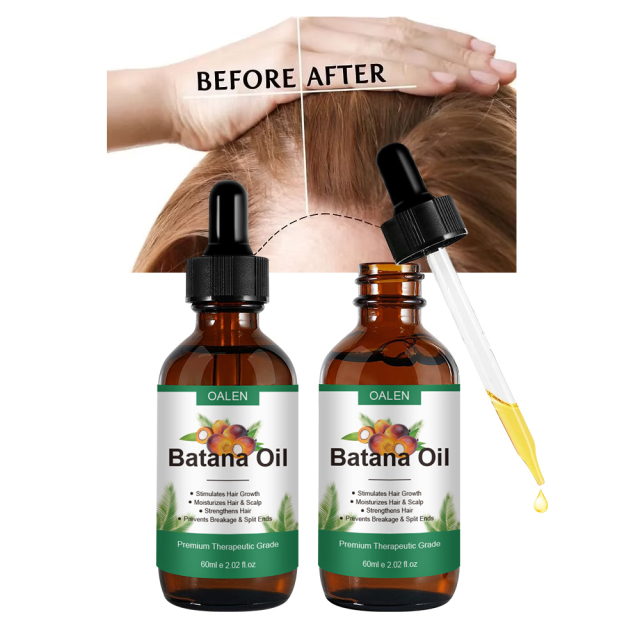 100% Pure Raw Batana Hair Oil Moisturizing Repair Damaged Hair Regrowth Oil,MY SHOP