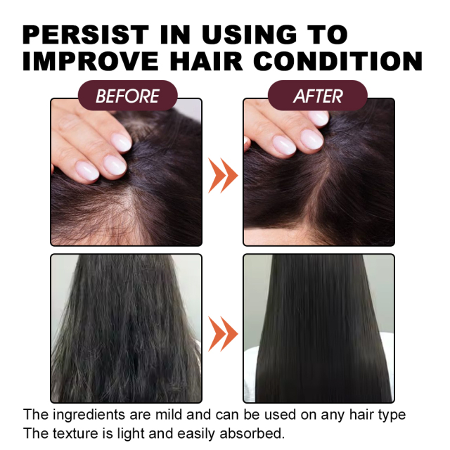 Organic Hair Oil Dry Scalp Treatment Soften Smooth Thicken Hair Promote Hair Growth Pure Batana Oil,oalen cosmetics