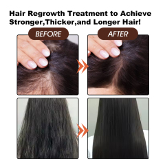 New Product Promoting Hair Growth Batana Oil 100% Natural Pure Organic Hair Batana Oil for Hair Growth,oalen cosmetics