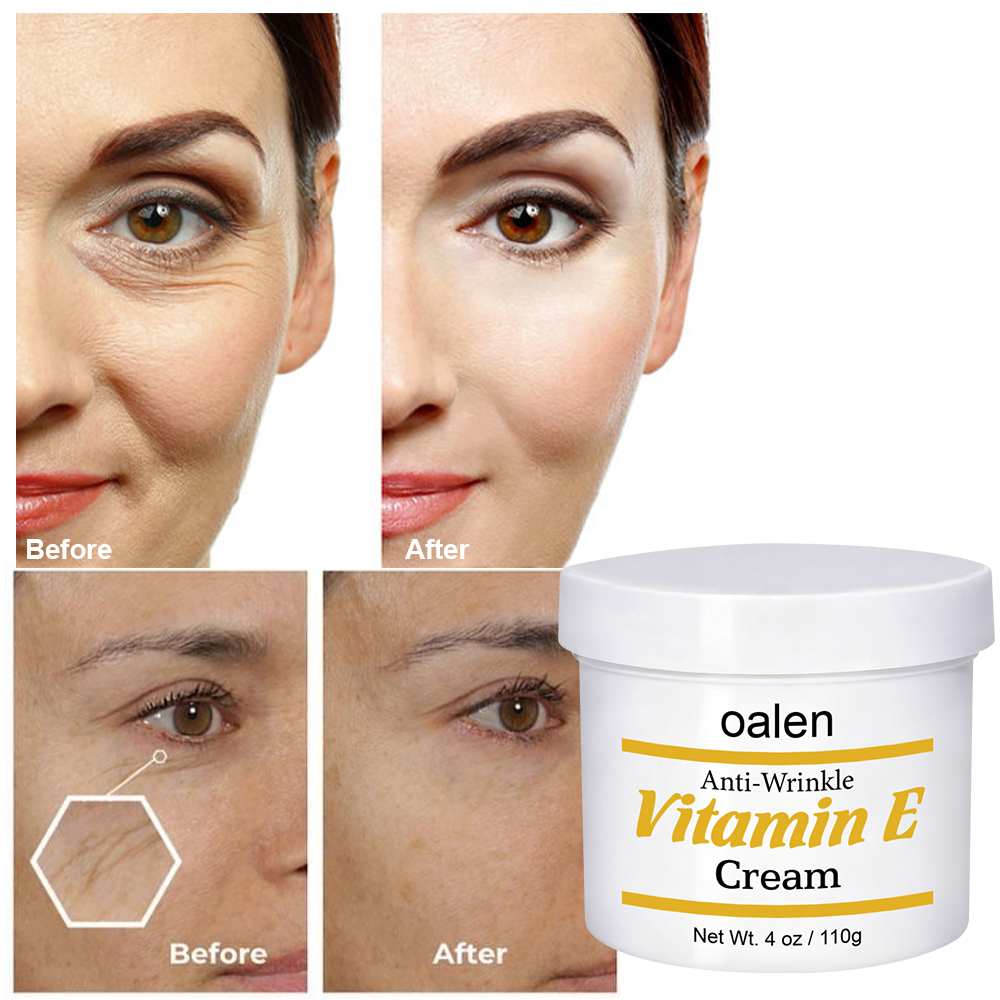 Extract Anti-wrinkle Face Cream Custom Logo Organic Plant  Vitamin E Face Cream,oalen cosmetics