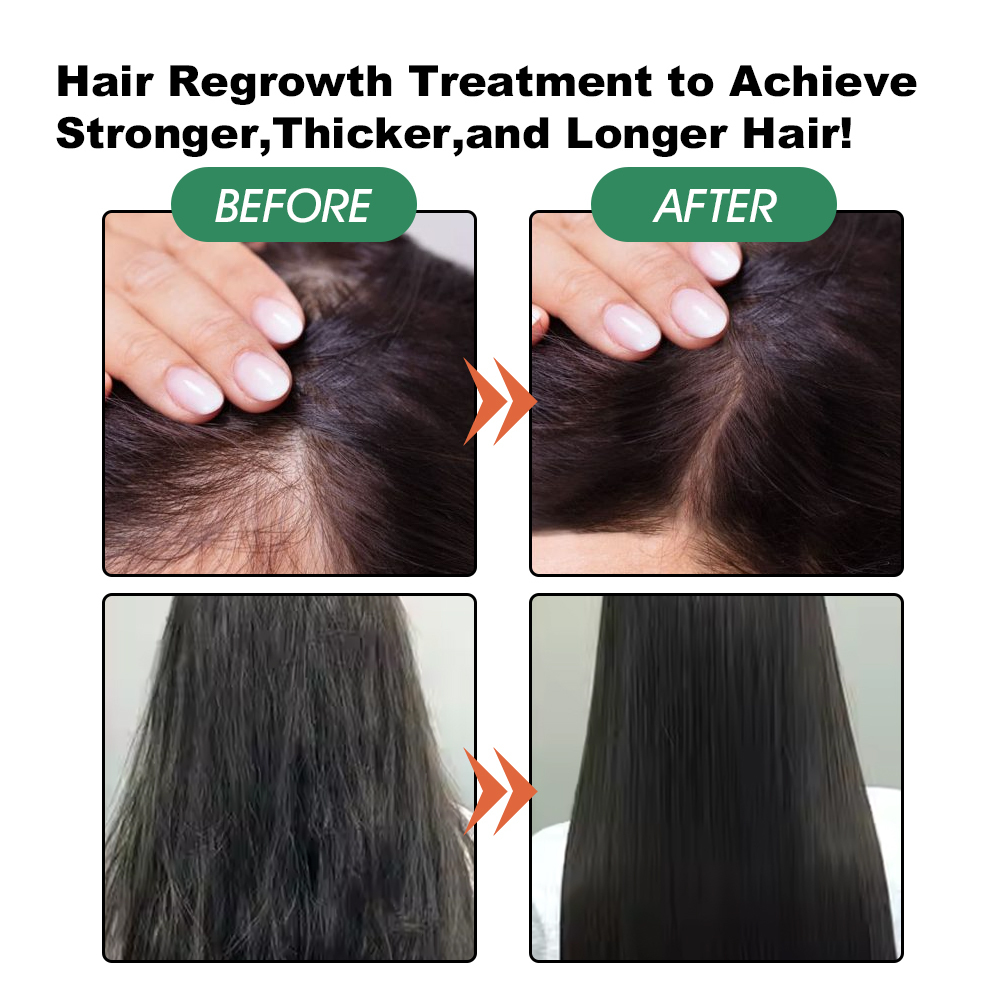 Hair Growth Serum Oil Moisturizing Essential Oil for Hair Growth,oalen cosmetics