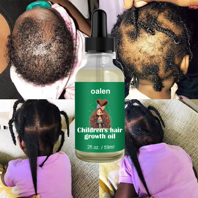 Customized Logo Private Label Baby Hair Moisturizer Kid Hair Oil Organic Natural Hair Growth Oil for Kid,oalen cosmetics