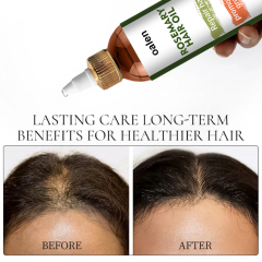 Anti Hair Fall Non Greasy Nourishing Natural Hair Care Mist Thickening Spray Rosemary Hair Growth Spray,MY SHOP