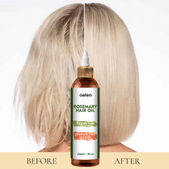 Anti Hair Fall Non Greasy Nourishing Natural Hair Care Mist Thickening Spray Rosemary Hair Growth Spray,MY SHOP