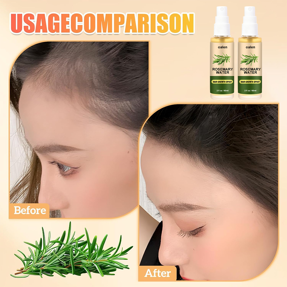 Luxfume Private Label organic Rosemary Water Hair Spray Vegan Promote Hair Regrowth Anti Loss Strengthens Hair growth Spray,oalen cosmetics