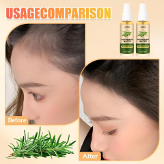 Luxfume Private Label organic Rosemary Water Hair Spray Vegan Promote Hair Regrowth Anti Loss Strengthens Hair growth Spray,oalen cosmetics