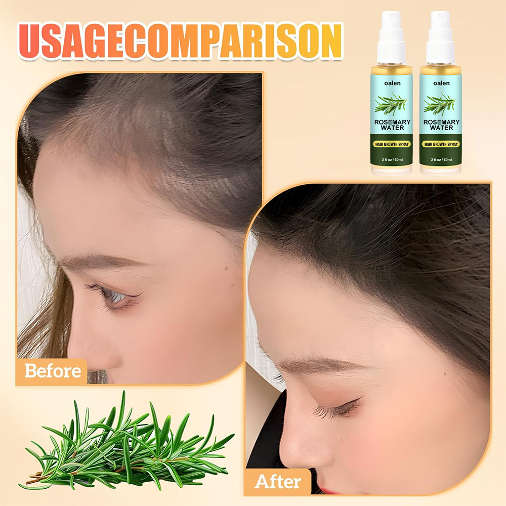 Organic Rosemary Water Hair Spray Vegan Promote Hair Regrowth Anti Loss Strengthens Hair growth Spray,oalen cosmetics