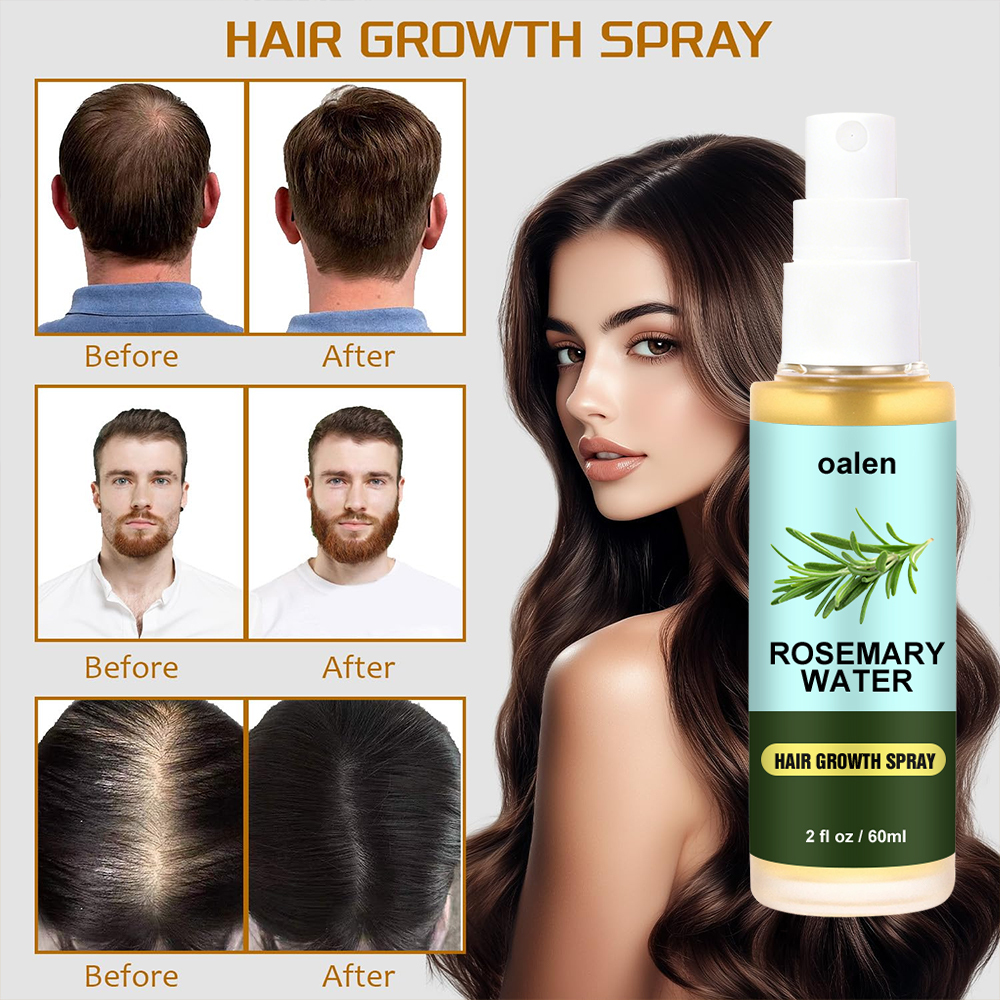 Organic Rosemary Water Hair Spray Vegan Promote Hair Regrowth Anti Loss Strengthens Hair growth Spray,oalen cosmetics