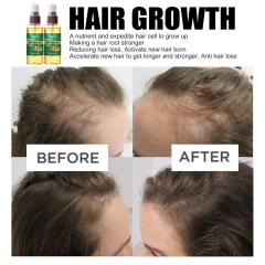 Luxfume Wholesale Organic Hair Regrowth Spray Anti Loss Ginger Natural Hair Growth Nourishing Serum Oil Mist,oalen cosmetics