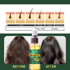 Luxfume Wholesale Organic Hair Regrowth Spray Anti Loss Ginger Natural Hair Growth Nourishing Serum Oil Mist,oalen cosmetics