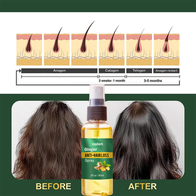Luxfume Wholesale Organic Hair Regrowth Spray Anti Loss Ginger Natural Hair Growth Nourishing Serum Oil Mist,oalen cosmetics