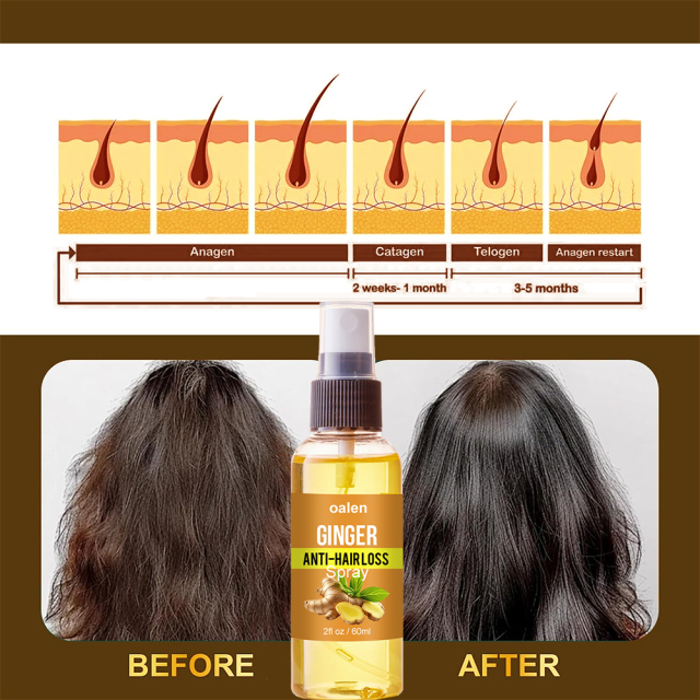 Anti Loss Ginger Natural Hair Growth Nourishing Serum Oil Mist Organic Hair Regrowth Spray,MY SHOP