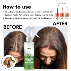 New Bunee Hair Lotion Health Product Hair Loss Regrowth Treatments 100ml Hair Growth Liquid Scalp Spray Serum,oalen cosmetics
