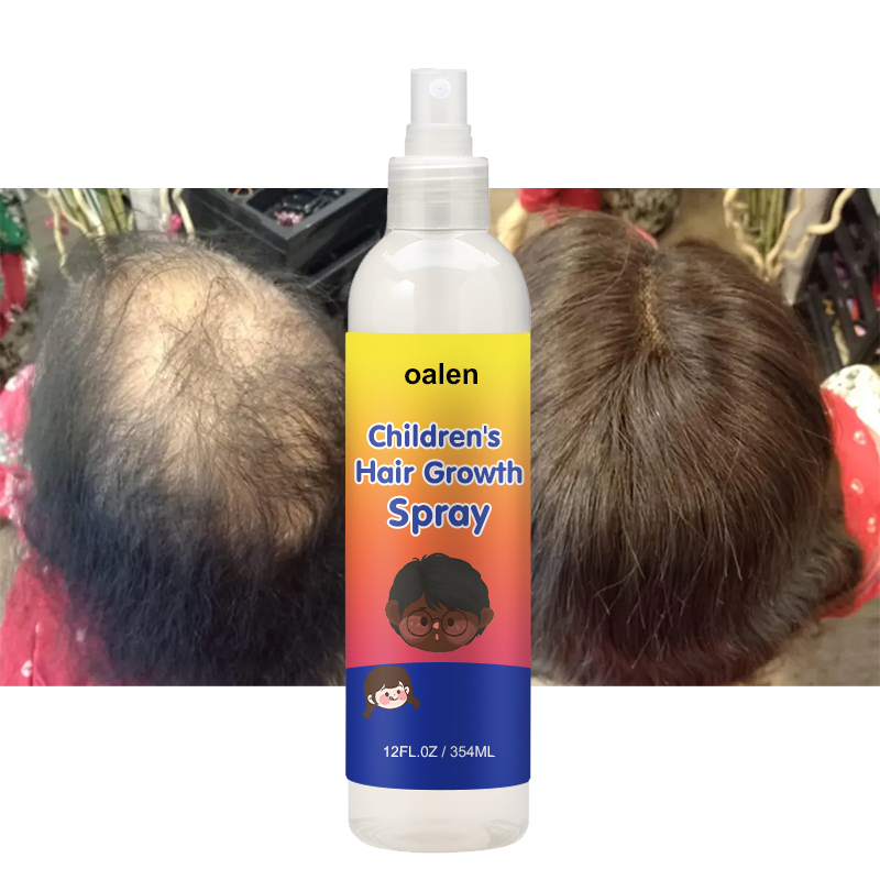 Private Label Children's Hair Growth Spray,MY SHOP