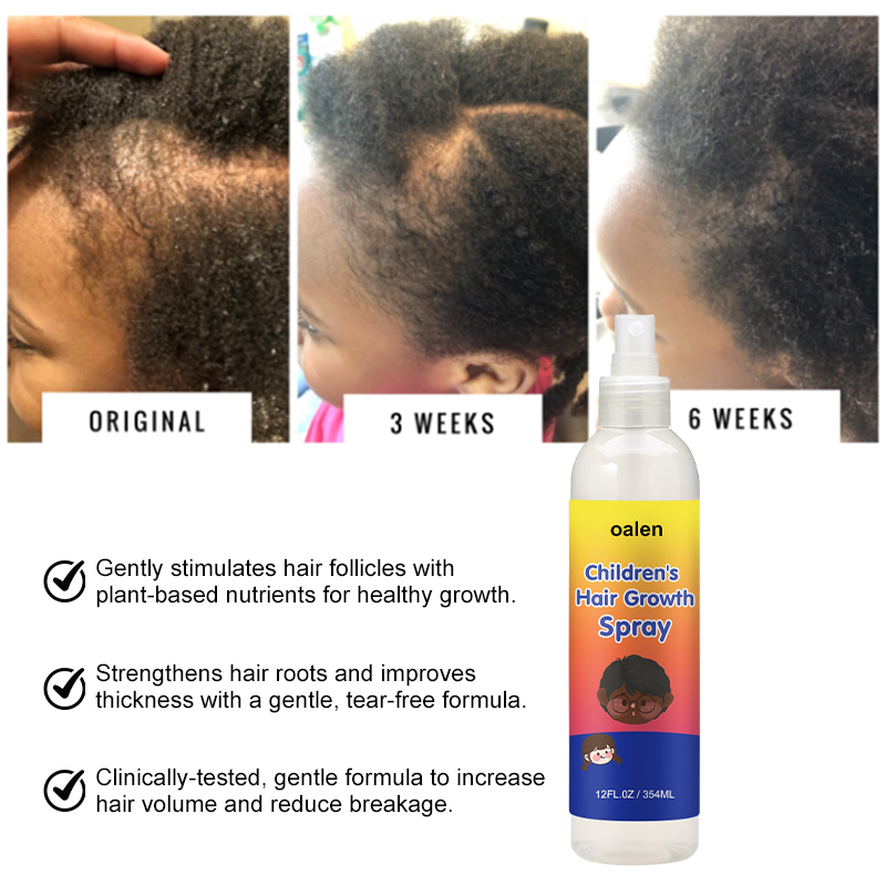 Private Label Children's Hair Growth Spray,MY SHOP