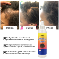 Private Label Children's Hair Growth Spray,MY SHOP