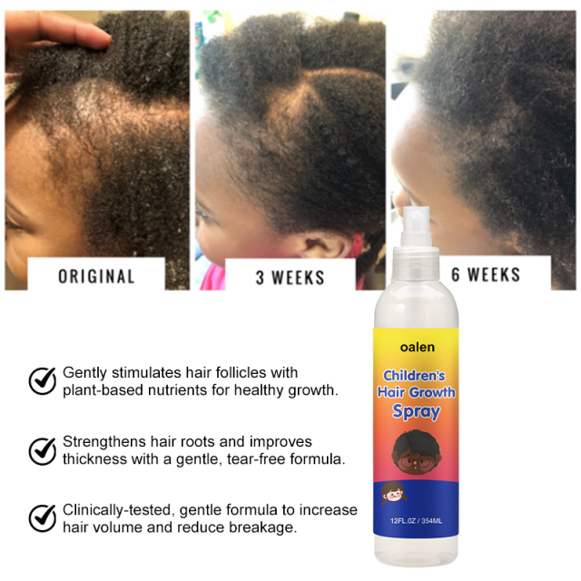 Private Label Children's Hair Growth Spray,MY SHOP