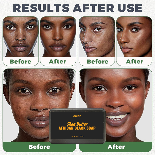 Private Label Shea Butter Enriched African Black Soap,oalen cosmetics