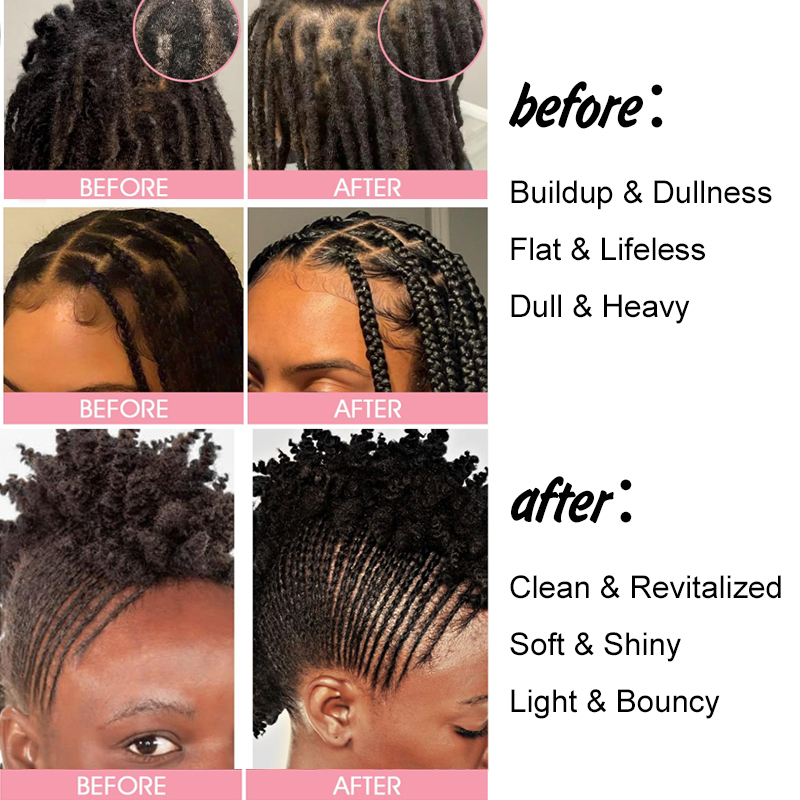 Luxfume Braid Scalp Cleaning Rinse,MY SHOP