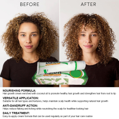 Private Label Fast Hair Growth Creme,oalen cosmetics