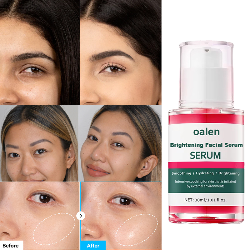 Private Label 30ml Face Serum Brightening Formula,oalen cosmetics