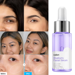 Private Label Blueberry Face  Serum,oalen cosmetics
