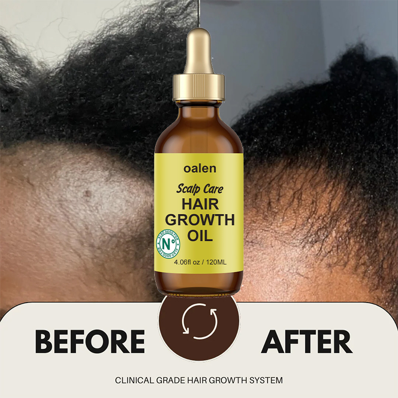 Luxfume Revitalizing Hair Growth Oil,MY SHOP