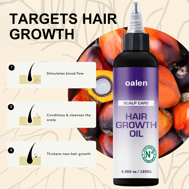 Luxfume Advanced Anti Thinning Hair Growth Oil,oalen cosmetics