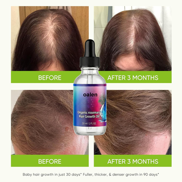 Private Label Rosemary Oil for Hair Growth Organic Formula for Hair Loss Control Nourish Scalp Stimulate Follicles,oalen cosmetics