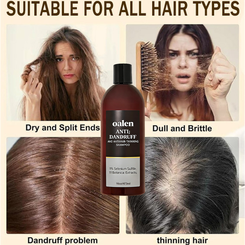 Private Label Professional Anti Dandruff Shampoo Anti Thinning Hair Loss Solution Moisturizing Scalp Care for Dry Itchy Scalp,MY SHOP