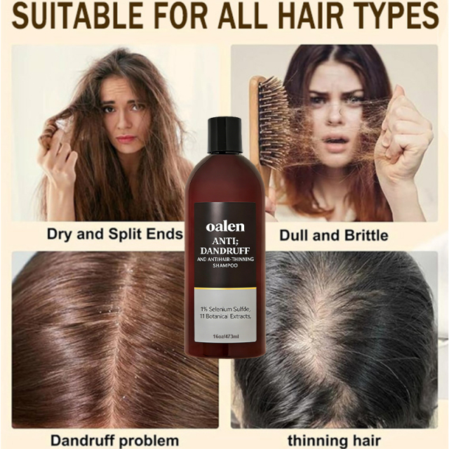 Private Label Professional Anti Dandruff Shampoo Anti Thinning Hair Loss Solution Moisturizing Scalp Care for Dry Itchy Scalp,MY SHOP