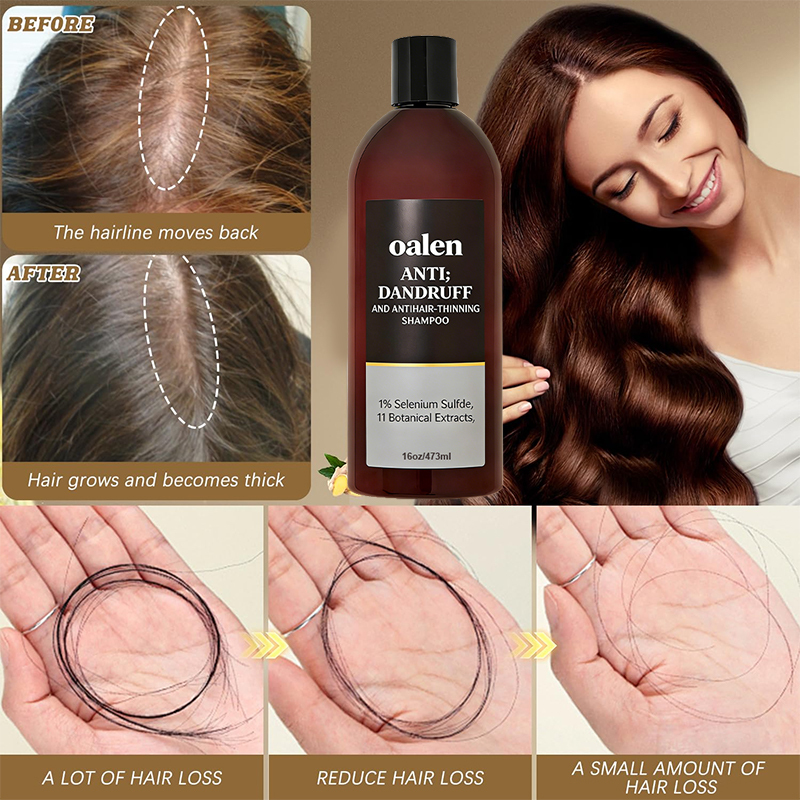 Private Label Professional Anti Dandruff Shampoo Anti Thinning Hair Loss Solution Moisturizing Scalp Care for Dry Itchy Scalp,MY SHOP