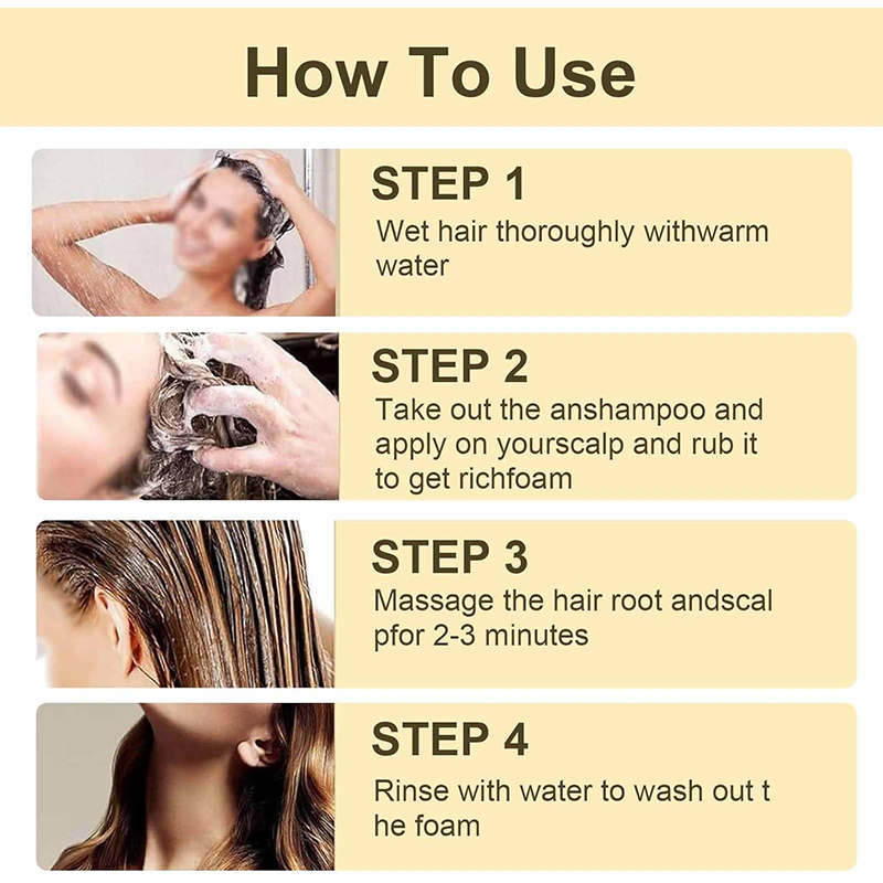 Private Label Professional Anti Dandruff Shampoo Anti Thinning Hair Loss Solution Moisturizing Scalp Care for Dry Itchy Scalp,MY SHOP