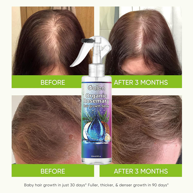 Private Label Natural Organic Rosemary Water Hair Growth Spray Anti Hair Loss Essence for Thinning Hair Scalp Treatment Spray for Women Men,MY SHOP