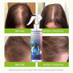 Private Label Natural Organic Rosemary Water Hair Growth Spray Anti Hair Loss Essence for Thinning Hair Scalp Treatment Spray for Women Men,MY SHOP