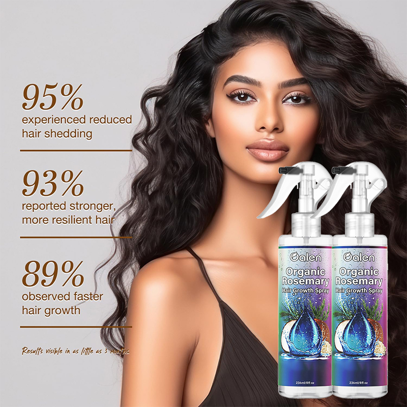Private Label Natural Organic Rosemary Water Hair Growth Spray Anti Hair Loss Essence for Thinning Hair Scalp Treatment Spray for Women Men,MY SHOP