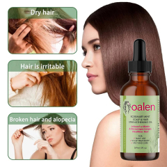 Private Label Rosemary Mint Scalp Hair Strengthening Oil Natural Organic Treatment for Hair Growth Thinning Hair Dry Scalp Split Ends,MY SHOP