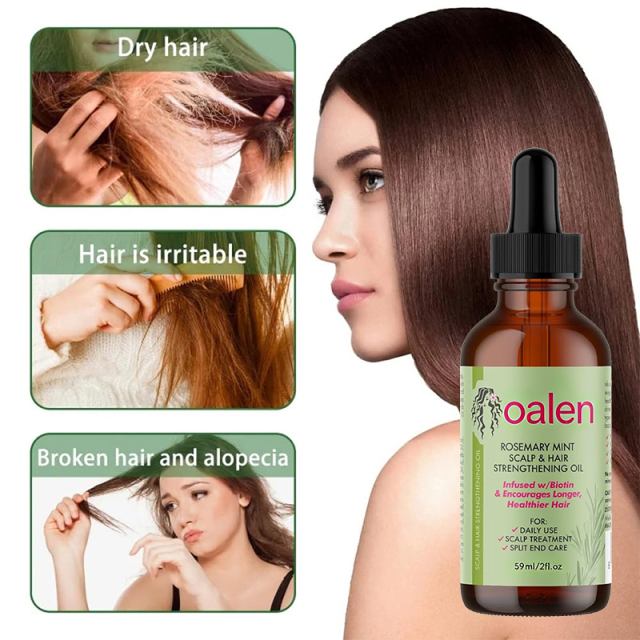 Private Label Rosemary Mint Scalp Hair Strengthening Oil Natural Organic Treatment for Hair Growth Thinning Hair Dry Scalp Split Ends,MY SHOP