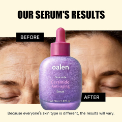 Private Label Ceramide Shot Ampoule Anti Aging and Hydrating Serum for Deep Moisturization for Dry Rough Skin to Reduce Wrinkles,oalen cosmetics