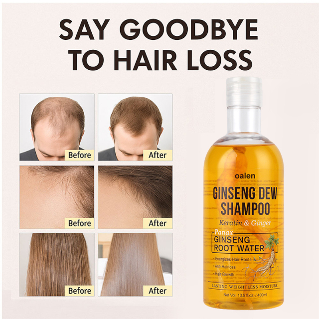 Private Label Ginseng Dew Shampoo Revitalize Your Scalp Strengthening Shampoo to Fortify Against Hair Loss Damage,MY SHOP