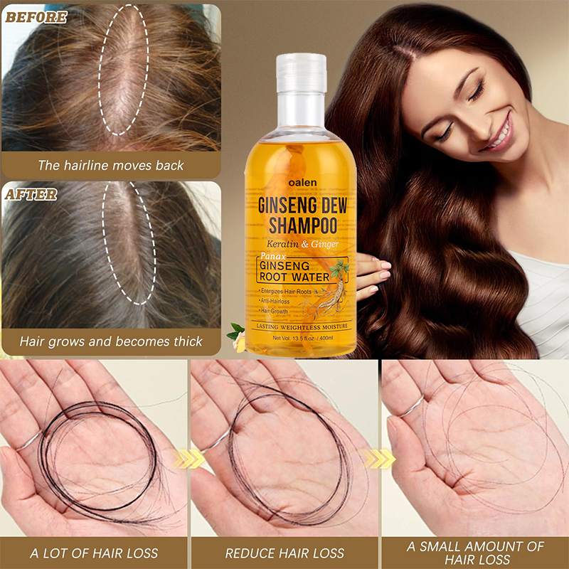 Private Label Ginseng Dew Shampoo Revitalize Your Scalp Strengthening Shampoo to Fortify Against Hair Loss Damage,MY SHOP