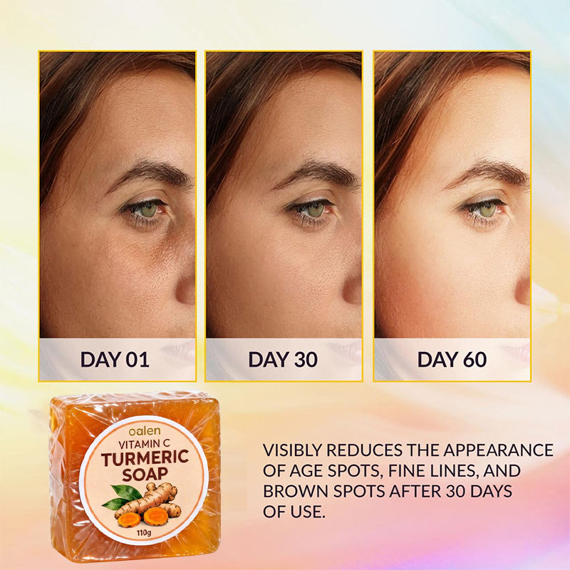 Oalen Turmeric Soap Bathing Kojic Acid Dark Spot Remover Soap with Vitamin c for Smooth Soft Skin Daily Use,oalen cosmetics