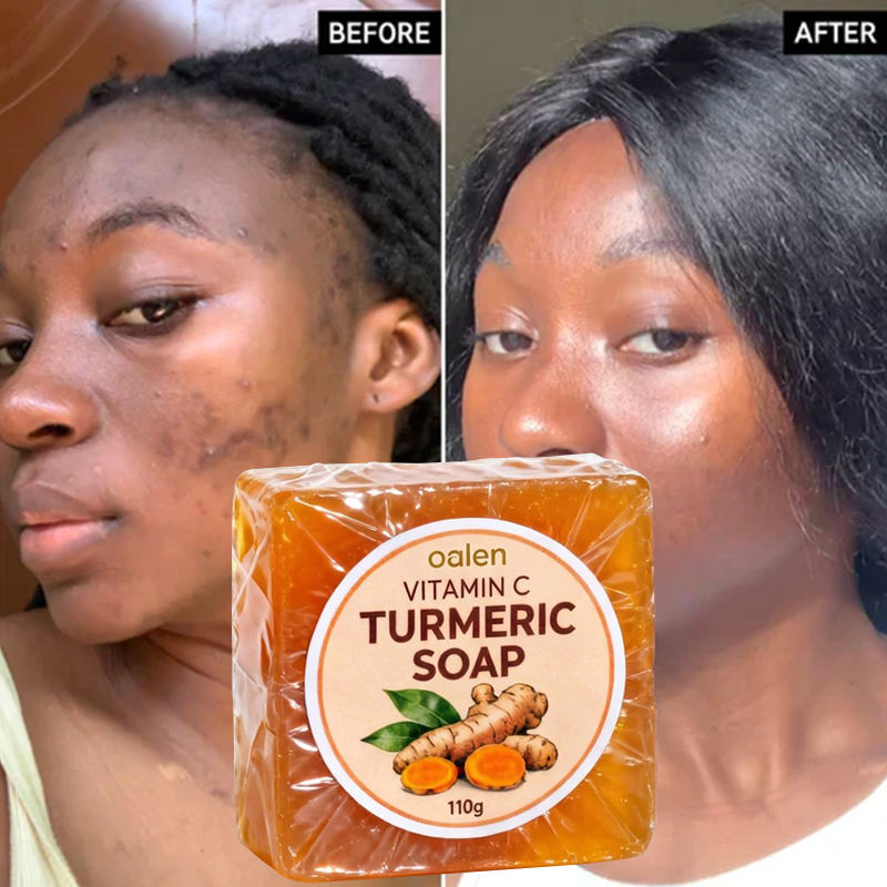 Oalen Turmeric Soap Bathing Kojic Acid Dark Spot Remover Soap with Vitamin c for Smooth Soft Skin Daily Use,oalen cosmetics